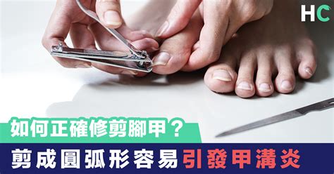 怎麼剪腳指甲|【生活知識】如何正確修剪腳甲？剪成圓弧形容易引發。